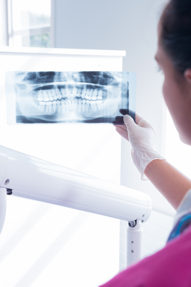 Dental XRay Services Hamilton Dental Group